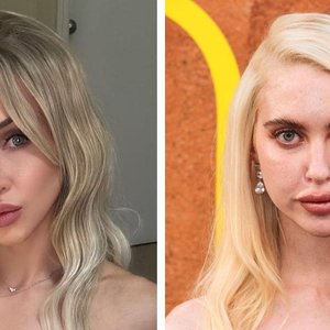 Alix Lynx Claps Back at 'Euphoria' Star's OnlyFans Critique