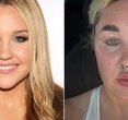 Amanda Bynes Stuns with New Lip Fillers and Weight Loss Glow at 39!