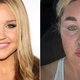 Amanda Bynes Stuns with New Lip Fillers and Weight Loss Glow at 39!