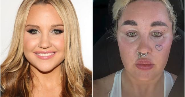 Amanda Bynes Stuns with New Lip Fillers and Weight Loss Glow at 39!