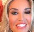 Christine McGuinness Turns Heads with Bold Move to Adult-Only Platform Post-Divorce