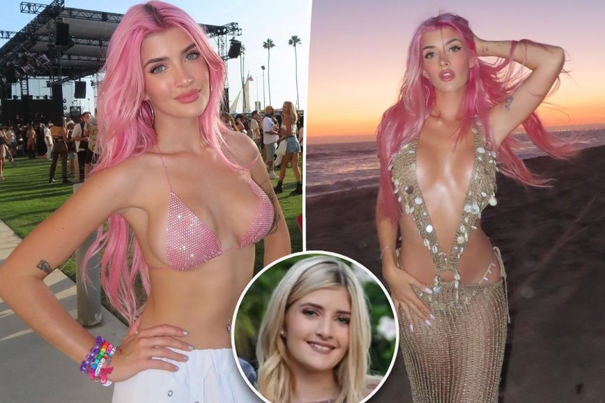 Sami Sheen’s Stunning Transformation: Denise Richards’ Daughter Spills All on Plastic Surgery!