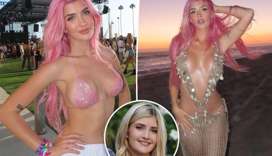 Sami Sheen’s Stunning Transformation: Denise Richards’ Daughter Spills All on Plastic Surgery!
