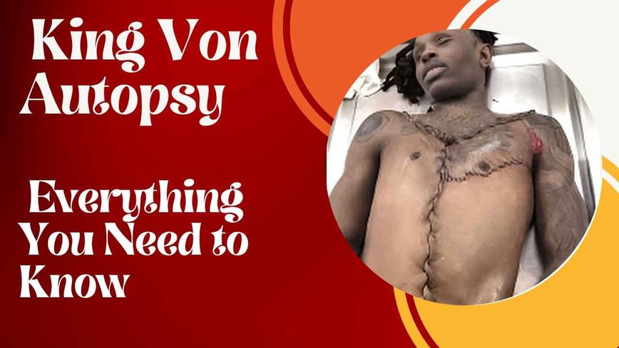 Unveiling the Truth: King Von's Autopsy and Its Impact on Hip-Hop