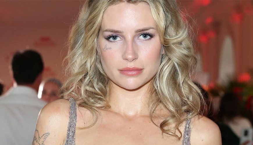 Lottie Moss Inches Closer to Erasing Her Famous Face Tattoo