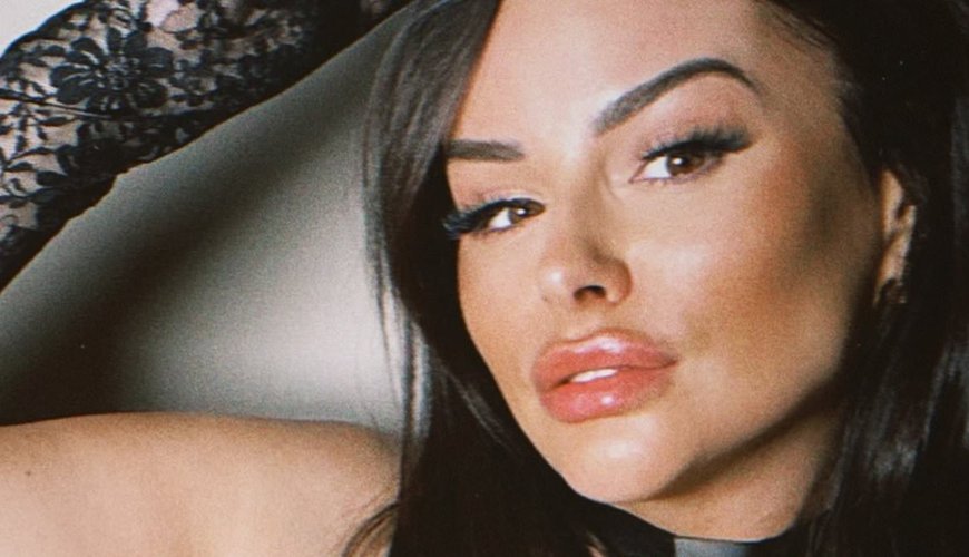 Rhian Sugden Stuns in Skintight Cat Costume Post Breast Reduction