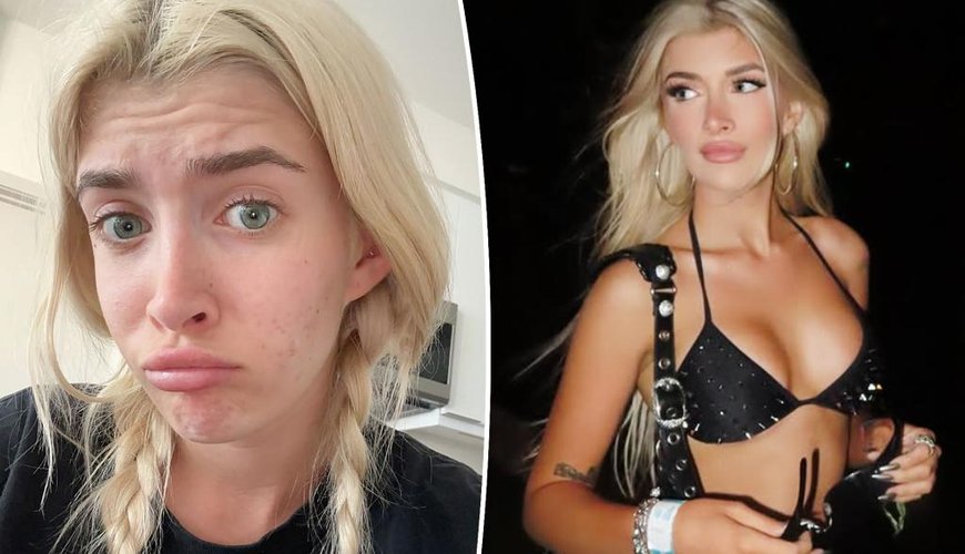 Sami Sheen’s Halloween Dilemma: Delaying Breast Implant Removal for a Pamela Anderson Costume